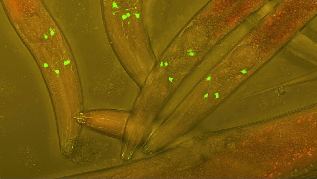 C. elegans worms with green fluorescent protein (GFP) inserted into their neurons to visualize neural development. Photo Credit: Heiti Paves, Wikimedia Commons.